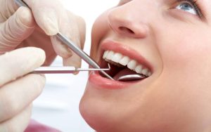 In general dentistry, common filling types include amalgam, composite resin, gold, and ceramic.