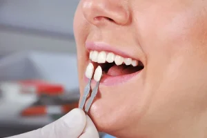 From Cleanings To Veneers Exploring The Full Spectrum Of Dental Care