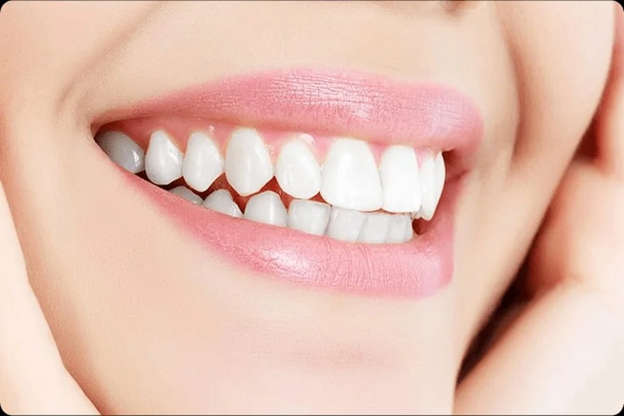 Teeth Whitening And More Cosmetic Services Your Family Can Trust
